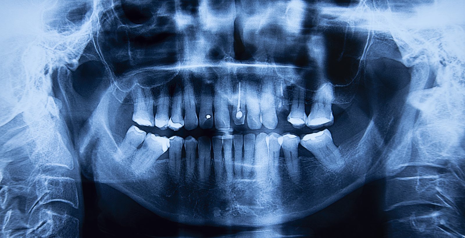 Restorative Dentistry